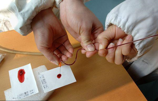 惠州什么情况上户口需要做亲子鉴定？